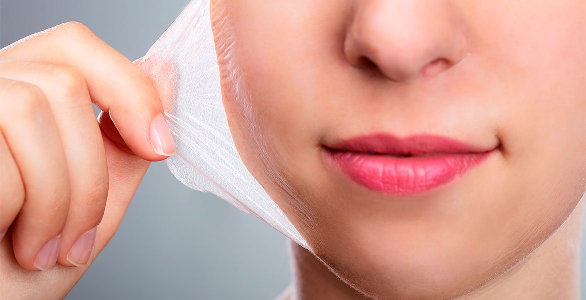 Peeling: saiba quais são os tipos de procedimento
